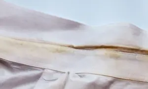Colletto di camicia con evidenti macchie gialle, simili a quelle che si formano su asciugamani colorati dopo l'uso.