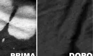 Split image showing a black fabric with white bleach stains on the left ("PRIMA") and the same fabric with the stains removed on the right ("DOPO").